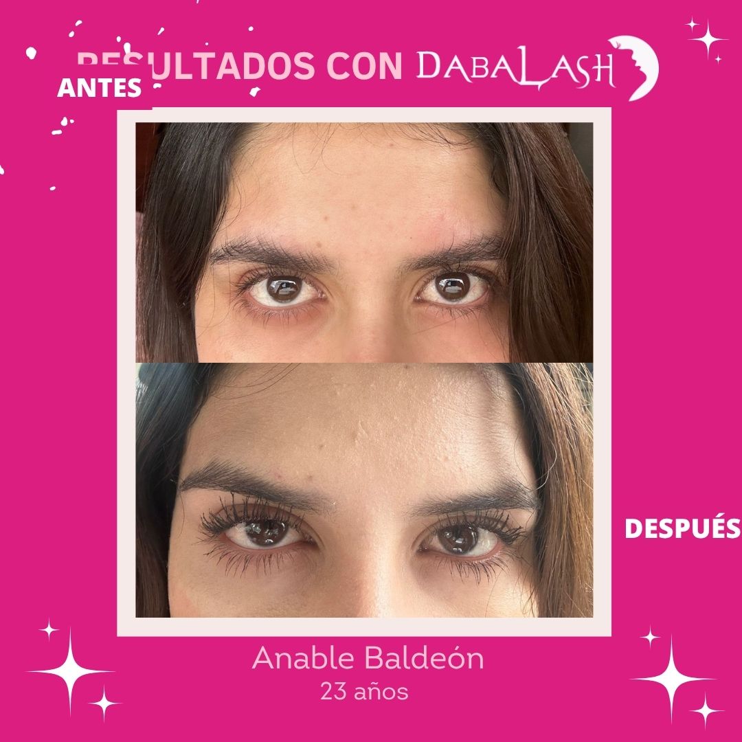 Testimonios de crecimiento de pesta&ntilde;as 